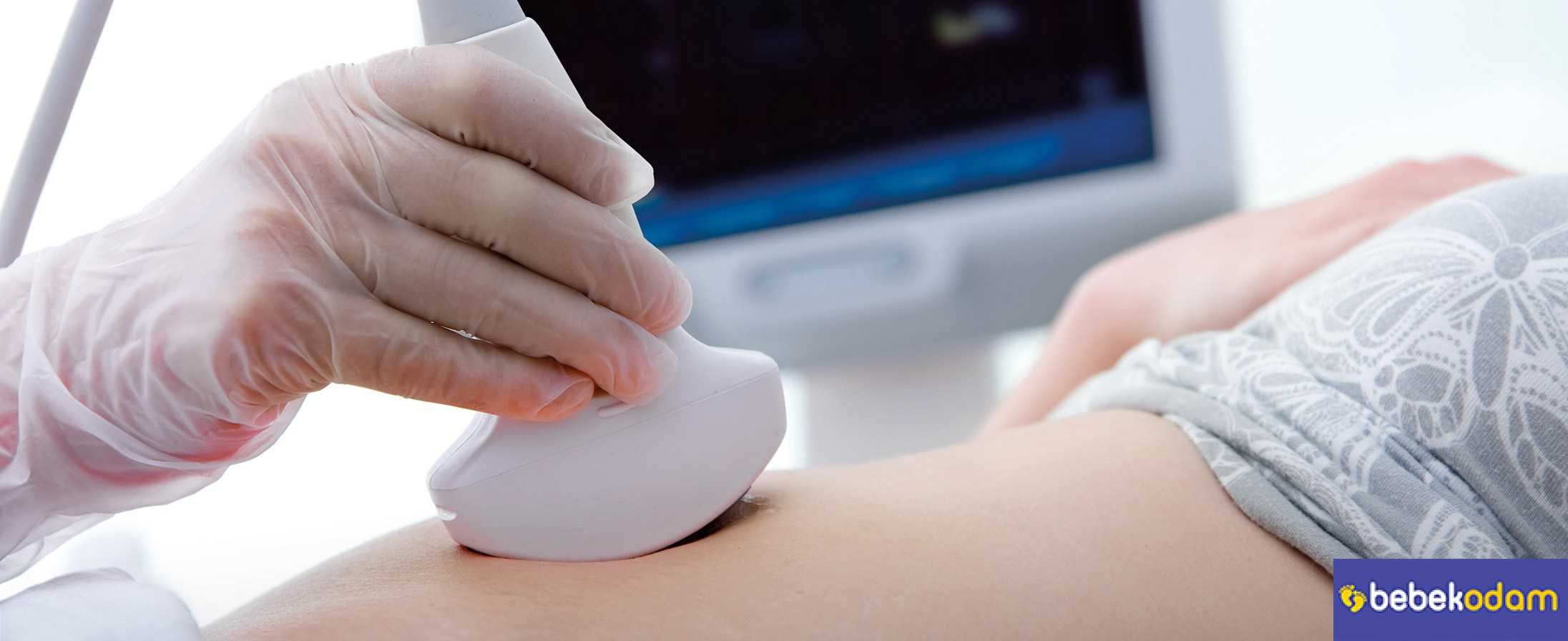 Down Sendrom Testleri Ne Zaman Yapılıyor?